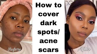 Remove DARK SPOTS amp SCARS NATURALLY  ACNE SCARS HYPERPIGMENTATION BLACK SPOTS ACNE MARKS 2021 [upl. by Iru]