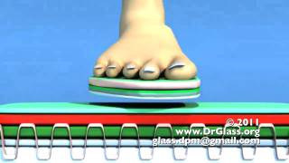 Armstrong Insole Shear Reduction Orthotic Diabetic [upl. by Gayler]