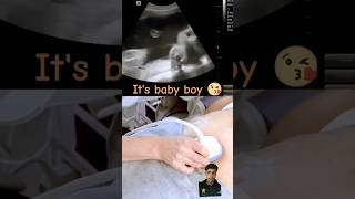 Ultrasound showing boy baby 🤰 shorts trending [upl. by Ahsiekim]