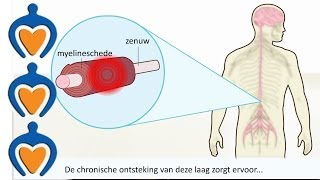 Multiple Sclerose MS  Wat is het en wat zijn de symptomen [upl. by Lirbaj]