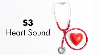 S3 Heart Sound  MEDZCOOL [upl. by Netsrijk]