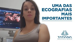 Ecografia gestacional morfológica do 2° Trimestre   Tatiana Coury [upl. by Harelda]