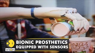 Lowcost bionic prosthetics arm equipped with sensors is transforming lives  World English News [upl. by Ahsikyw]