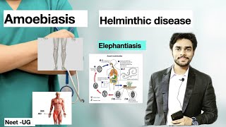 neetug NCERT  protozoan disease helminthic disease  fungal disease lec 6 by Dr Akash Singh [upl. by Ahsrats]