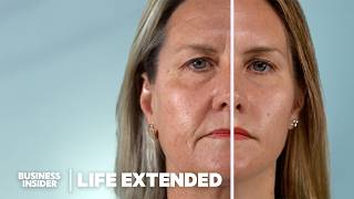 Scientists Are Closer Than Ever To Reverse Aging How Does It Work  Life Extended [upl. by Alby]