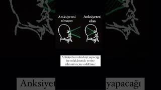 Anksiyetesi olan ve olmayan psikoloji bilgi anksiyete zihin psikolojikbilgiler [upl. by Karlen]