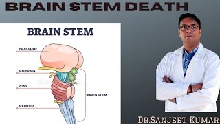 Tutorial 81  BRAIN STEM DEATH [upl. by Leandro]