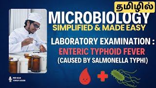 Hemoculture🩸 examination 🧪in Enteric Typhoid Fever 🤒 EASY EXPLANATION தமிழில்  Microbiology 🧫 [upl. by Eidderf825]