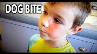 DOG BITE To The FACE Hilarious Kid Tells the Story  Dr Paul [upl. by Amjan]