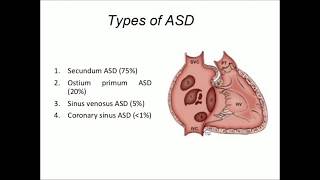 Atrial Septal Defect and Keyhole Treatment [upl. by Twum]