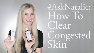 How To Clear Bumpy Congested Skin  Eminence Organics [upl. by Nymassej]