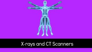 Xrays and CT Scanners  How Do They Work and What are the Problems  GCSE Physics [upl. by Josee]