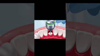 Teeth Cleaning ASMR Animation asmr animation shorts youtubeshorts [upl. by Eivad959]