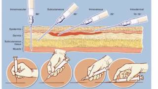 Types of Syringes and Needles  Gwaymedicalcom [upl. by Awra942]