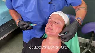 CELLBOOSTER® SHAPE LIFT amp GLOW Combination Treatment amp Injections techniques by Dr Hervé PADEY [upl. by Bores852]