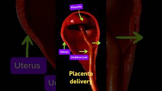 Delivery of the placenta pregnant placenta baby [upl. by Yllut149]