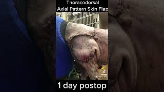 Thoracodorsal Axial Pattern Skin Flap [upl. by Aneerol]