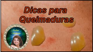 Dicas para Queimaduras [upl. by Schechter]