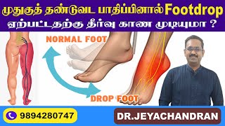 FOOT DROP ANKLE கணுக்கால் நரம்பு பாதிப்பு SCIATICA முதுகு தண்டுவட நரம்பு பாதிப்பு சன் மருத்துவமனை [upl. by Darcy]