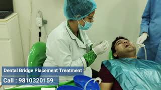 Dental Bridge Procedure Dwarka Delhi India [upl. by Ydwor537]