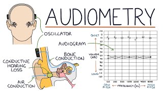 Understanding Audiometry and Audiograms [upl. by Alidus713]