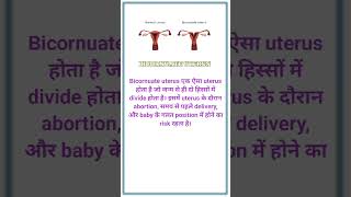 Bicornuate uterus uterus obg medical delivery ytshorts trendingshorts trending youtub lab [upl. by Odom617]