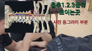 경장근 촉진longus colli palpation 및 도수운동manipulation motion 뒷목이 뻐근할때ㅡ》 경장근이 이완이 안되서 경추 신전근이 뭉친경우 [upl. by Najar]