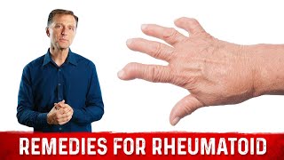 Best Remedies for Rheumatoid [upl. by Nats298]