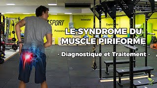 LE SYNDROME DU MUSCLE PIRIFORME Diagnostic et Traitement [upl. by Ariay]