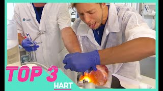 ELBERT OPEREERT EEN HART  TOPDOKS TOP 3 VIDEOS  TOPDOKS [upl. by Corenda]