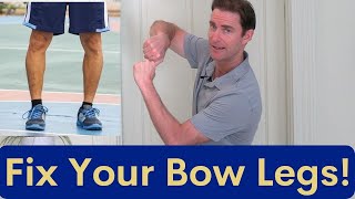 From BowLegged to Straight Legs The Ultimate Solution Revealed [upl. by Swor]