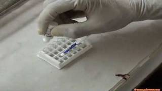 Rapid malaria test [upl. by Nottap]