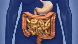 Screening for Colorectal Cancer [upl. by Doggett]