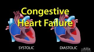 Congestive Heart Failure Leftsided vs Rightsided Systolic vs Diastolic Animation [upl. by Epilif48]