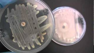 BIO 2192 UNIT 12  Susceptibility to Antibiotics  Novobiocin Sensitivity [upl. by Alley]