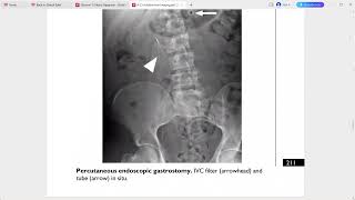 AZ OF ABDOMINAL RADIOLOGY [upl. by Annahael]