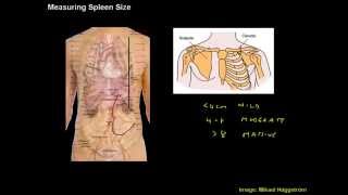 Measuring Spleen Size  Clinical Skills Made Easy [upl. by Deckert]