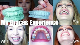 3 YEARS OF BRACES IN UNDER 30 MINS  VLOGstyle experience  transformation quotglowupquot [upl. by William747]