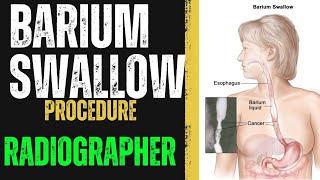 Barium Swallow Procedure  How to do Barium Swallow  Radiographer  X RAY Radiographer  Radiology [upl. by Nere]