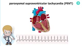 Types and ECG features of Supraventricular Tachycardia SVT [upl. by Esyak793]