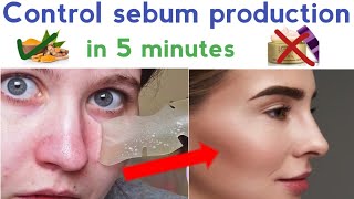 Sebaceous Gland Ablation SGA  the permanent Acne Pimple amp Breakout solution [upl. by Eedyaj423]