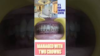 सामने का दांत अचानक टूट गया कैसे होगा ठीक Chipped tooth management [upl. by Assirram]