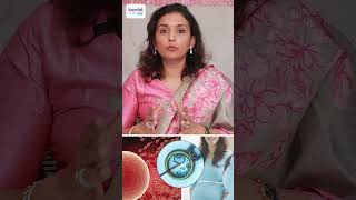 IVF Pregnancy இப்படித்தான் வேலை செய்கிறது  DrPriya Kalyani [upl. by Allyce]