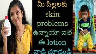 atogla baby lotion review telugumoisturizing lotion for babiesbest lotion for babies skin problems [upl. by Ilellan103]