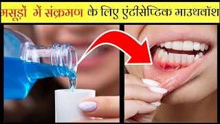 मसूड़ों में सूजन दातों और मुंह में संक्रमण को ठीक करने की दवा  Chlorhexidine antiseptic mouthwash [upl. by Wsan]