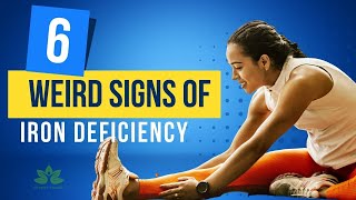 6 Weird Signs You Have an Iron Deficiency and What to Do About It [upl. by Ennovoj]