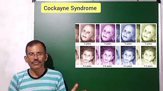 COCKAYNE SYNDROME SAM BIOLOGY 🧫 CLASS [upl. by Ainedrag]