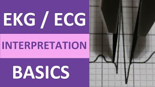 EKGECG Interpretation Basics Nursing NCLEX  QRS Complex P Wave T Wave PR Interval [upl. by Calvo]