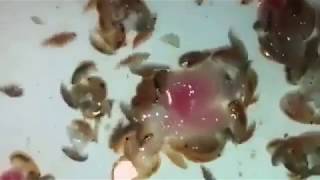 Sea lice feast on fresh meat in Australia after teenager left bloodied – video [upl. by Irrek]