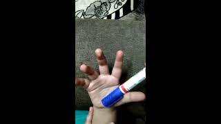 Pen Test  Median Nerve  How to do the pen test  Abductor policis brevis  abduction of thumb [upl. by Dionisio364]